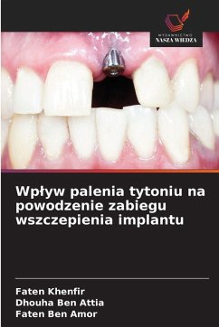 Wp¿yw palenia tytoniu na powodzenie zabiegu wszczepienia implantu - Khenfir, Faten;Ben Attia, Dhouha;Ben Amor, Faten Wp¿yw palenia tytoniu na powodzenie zabiegu wszczepienia implantu - Khenfir, Faten;Ben Attia, Dhouha;Ben Amor, Faten