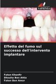 Effetto del fumo sul successo dell'intervento implantare Effetto del fumo sul successo dell'intervento implantare
