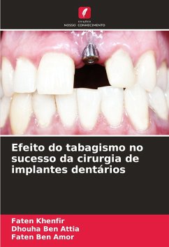 Cover Efeito do tabagismo no sucesso da cirurgia de implantes dentários