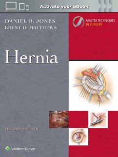 Master Techniques in Surgery: Hernia: Print + eBook with Multimedia - Jones, Daniel B; Matthews, Brent D Master Techniques in Surgery: Hernia: Print + eBook with Multimedia - Jones, Daniel B; Matthews, Brent D