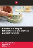 Fabrico de etapas laboratoriais de prótese parcial fundida