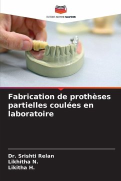 Fabrication de prothèses partielles coulées en laboratoire - Relan, Dr. Srishti;N., Likhitha;H., Likitha Fabrication de prothèses partielles coulées en laboratoire - Relan, Dr. Srishti;N., Likhitha;H., Likitha