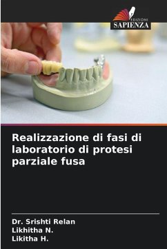 Realizzazione di fasi di laboratorio di protesi parziale fusa - Relan, Dr. Srishti;N., Likhitha;H., Likitha Realizzazione di fasi di laboratorio di protesi parziale fusa - Relan, Dr. Srishti;N., Likhitha;H., Likitha