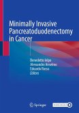 Minimally Invasive Pancreatoduodenectomy in Cancer (eBook, PDF)