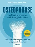 Osteoporose rechtzeitig erkennen und behandeln Osteoporose rechtzeitig erkennen und behandeln