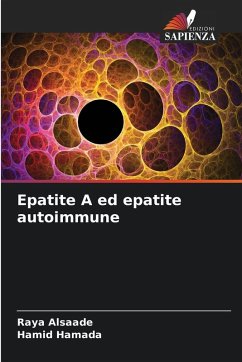 Epatite A ed epatite autoimmune - Alsaade, Raya;Hamada, Hamid Epatite A ed epatite autoimmune - Alsaade, Raya;Hamada, Hamid