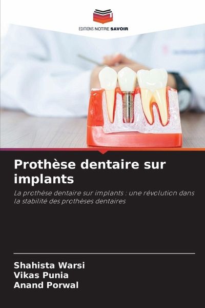 Prothèse dentaire sur implants