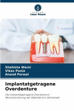 Cover Implantatgetragene Overdenture