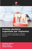 Prótese dentária suportada por implantes Prótese dentária suportada por implantes