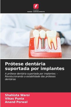 Cover Prótese dentária suportada por implantes