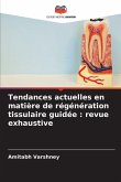 Tendances actuelles en matière de régénération tissulaire guidée : revue exhaustive