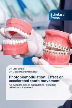 Photobiomodulation: Effect on accelerated tooth movement - Singla, Dr. Liza;Bhatanagar, Dr. Deepankar Photobiomodulation: Effect on accelerated tooth movement - Singla, Dr. Liza;Bhatanagar, Dr. Deepankar