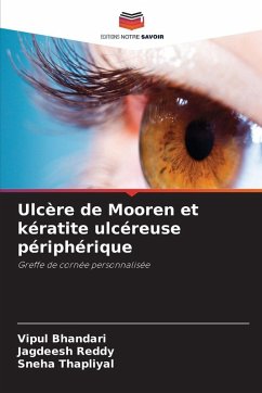 Cover Ulcère de Mooren et kératite ulcéreuse périphérique