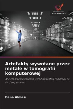Cover Artefakty wywo¿ane przez metale w tomografii komputerowej