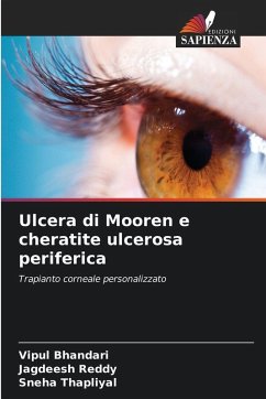 Cover Ulcera di Mooren e cheratite ulcerosa periferica