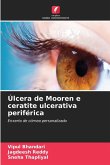 Úlcera de Mooren e ceratite ulcerativa periférica