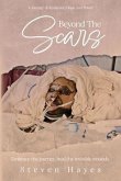 Beyond The Scars (eBook, ePUB)