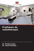 Prothèses de radiothérapie