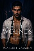Beautiful Wounds