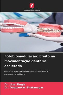 Cover Fotobiomodulação: Efeito na movimentação dentária acelerada