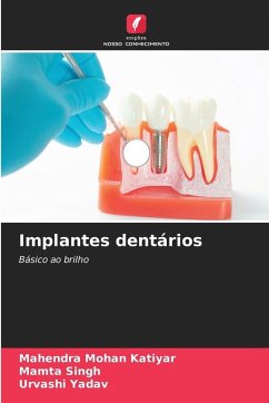 Cover Implantes dentários