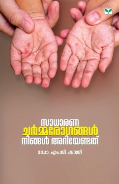 sadharana charmarogangal ningal ariyendathu - M. G. Shaji