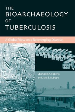 The Bioarchaeology of Tuberculosis (eBook, ePUB) - Roberts, Charlotte A.; Buikstra, Jane E. The Bioarchaeology of Tuberculosis (eBook, ePUB) - Roberts, Charlotte A.; Buikstra, Jane E.
