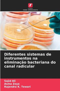 Diferentes sistemas de instrumentos na eliminação bacteriana do canal radicular - Ali, Sajid;Zoya, Asma;Tewari, Rajendra K.