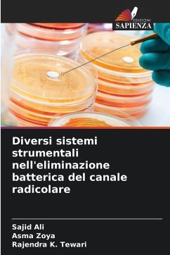 Diversi sistemi strumentali nell'eliminazione batterica del canale radicolare - Ali, Sajid;Zoya, Asma;Tewari, Rajendra K.