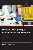 Druk 3D - nowy post¿p w periodontologii i implantologii