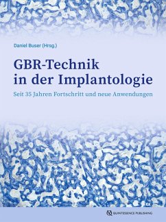 Cover GBR-Technik in der Implantologie (eBook, ePUB)