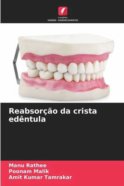 Reabsorção da crista edêntula Reabsorção da crista edêntula