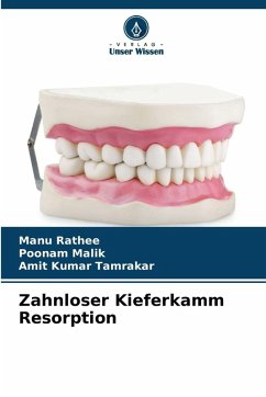 Cover Zahnloser Kieferkamm Resorption