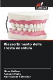 Riassorbimento della cresta edentula Riassorbimento della cresta edentula
