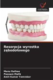 Resorpcja wyrostka z¿bodo¿owego