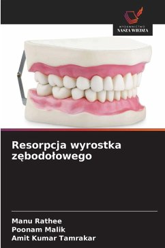 Cover Resorpcja wyrostka z¿bodo¿owego
