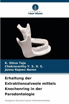 Cover Erhaltung der Extraktionsalveole mittels Knochenring in der Parodontologie