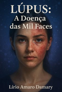 Cover Lúpus: A Doença Das Mil Faces (eBook, ePUB)
