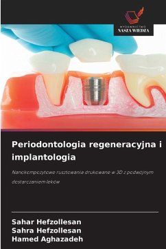 Periodontologia regeneracyjna i implantologia - Hefzollesan, Sahar;Hefzollesan, Sahra;Aghazadeh, Hamed