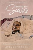 Beyond The Scars