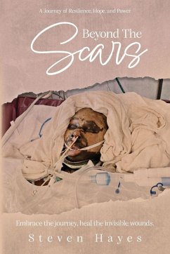 Cover Beyond The Scars