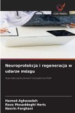 Neuroprotekcja i regeneracja w udarze mózgu Neuroprotekcja i regeneracja w udarze mózgu