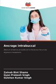 Ancrage intrabuccal
