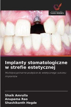Cover Implanty stomatologiczne w strefie estetycznej
