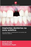 Implantes dentários na zona estética