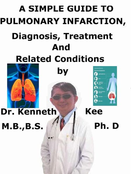 A Simple Guide to Pulmonary Infarction, Diagnosis, Treatment and Related Conditions (eBook, ePUB)