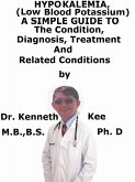 Hypokalemia, (Low Blood Potassium) A Simple Guide To The Condition, Diagnosis, Treatment And Related Conditions (eBook, ePUB)