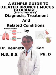 Cover A Simple Guide to Dilated Bronchi, Mucus Blockage (Bronchiectasis), Diagnosis, Treatment and Related Conditions (eBook, ePUB)