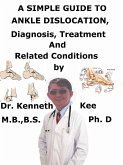A Simple Guide to Ankle Dislocation, Diagnosis, Treatment and Related Conditions (eBook, ePUB)