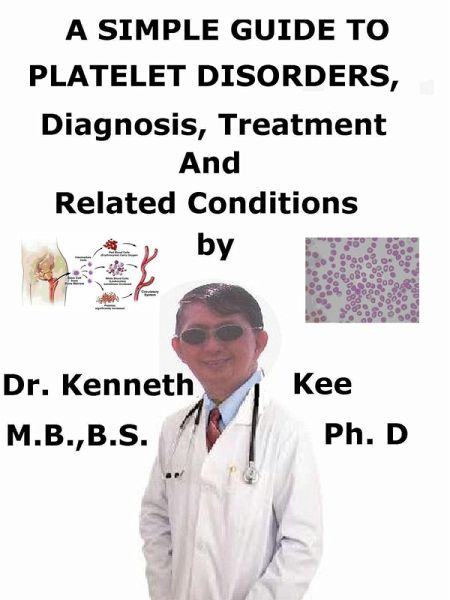 A Simple Guide to Platelet Disorders, Diagnosis, Treatment and Related Conditions (eBook, ePUB) A Simple Guide to Platelet Disorders, Diagnosis, Treatment and Related Conditions (eBook, ePUB)